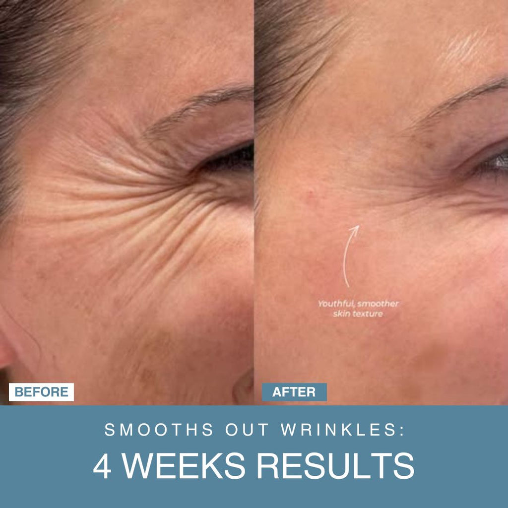 Powerglow™ 7-in-1 LED Facial Sculptor