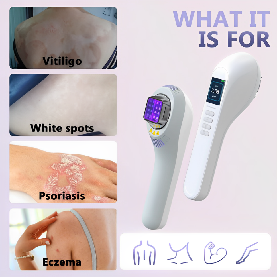 308nm UVB Lamp for Vitiligo Phototherapy Light Therapy for Psoriasis