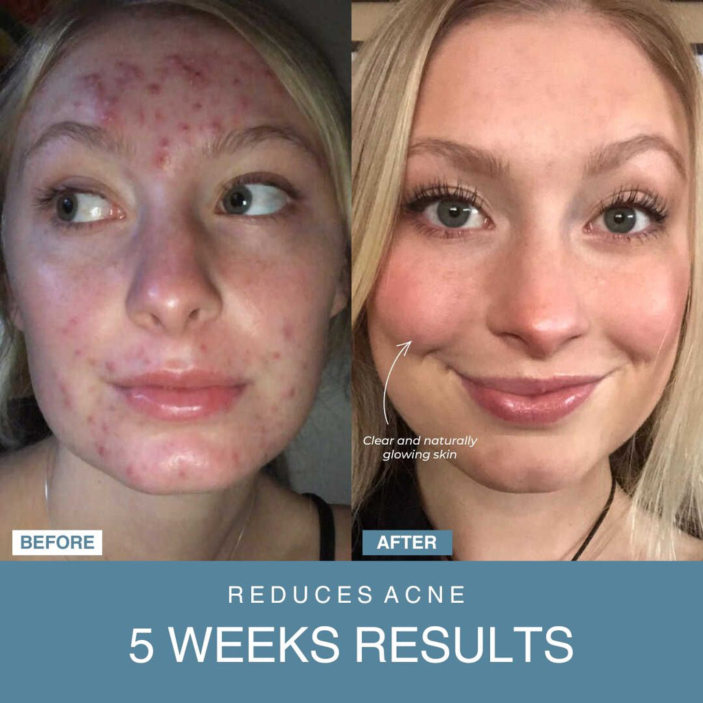 Powerglow™ 7-in-1 LED Facial Sculptor