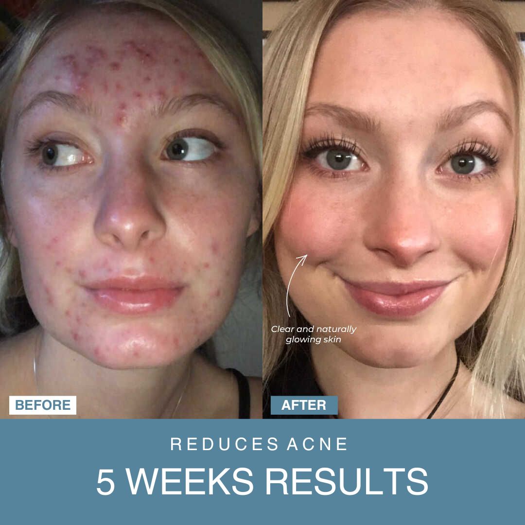 Powerglow™ 7-in-1 LED Facial Sculptor