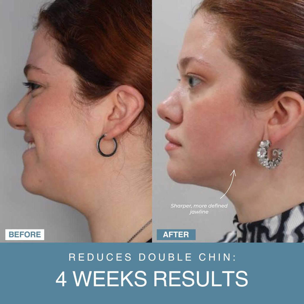 Powerglow™ 7-in-1 LED Facial Sculptor