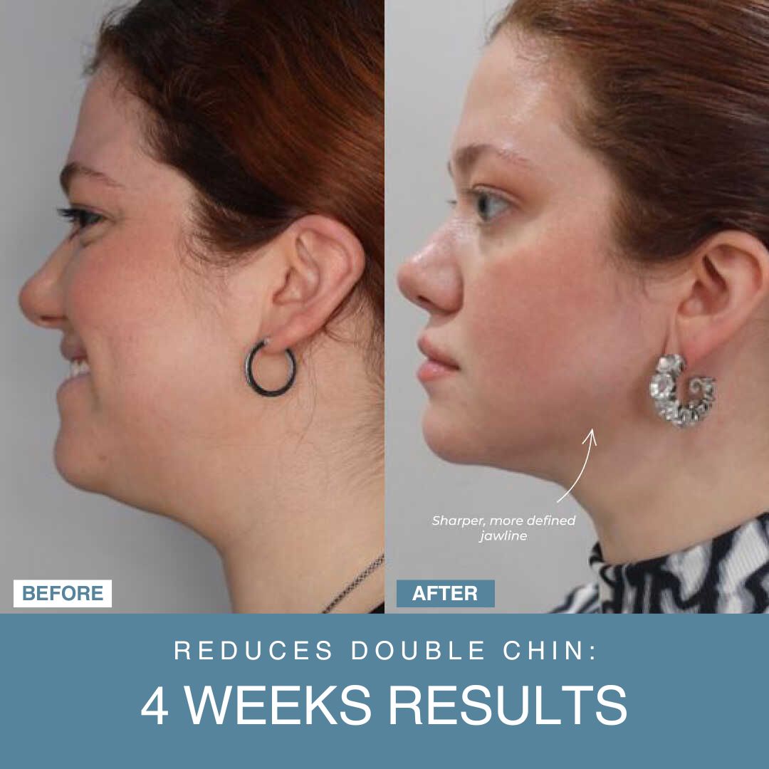 Powerglow™ 7-in-1 LED Facial Sculptor