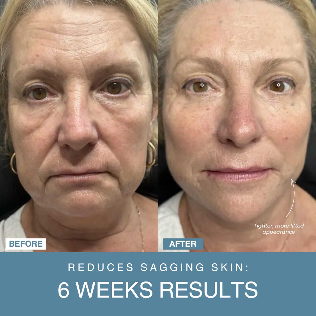 Powerglow™ 7-in-1 LED Facial Sculptor