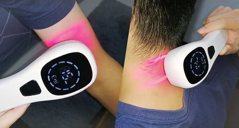 Vylepšené zařízení pro terapii červeným světlem s chlazeným laserem