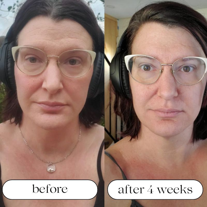 Medical Grade LED Light Therapy Machine