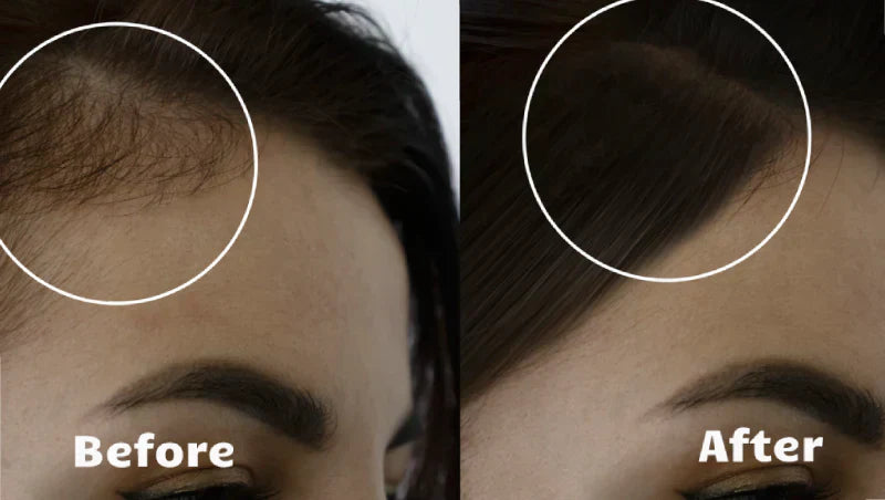 Light wave - Hustší, plnější, zdravější vlasy za 10 minut denně