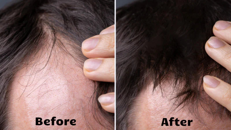 Light wave - Hustší, plnější, zdravější vlasy za 10 minut denně