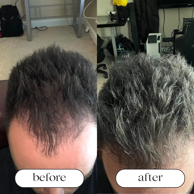 Red Light Therapy Cap for Hair Growth