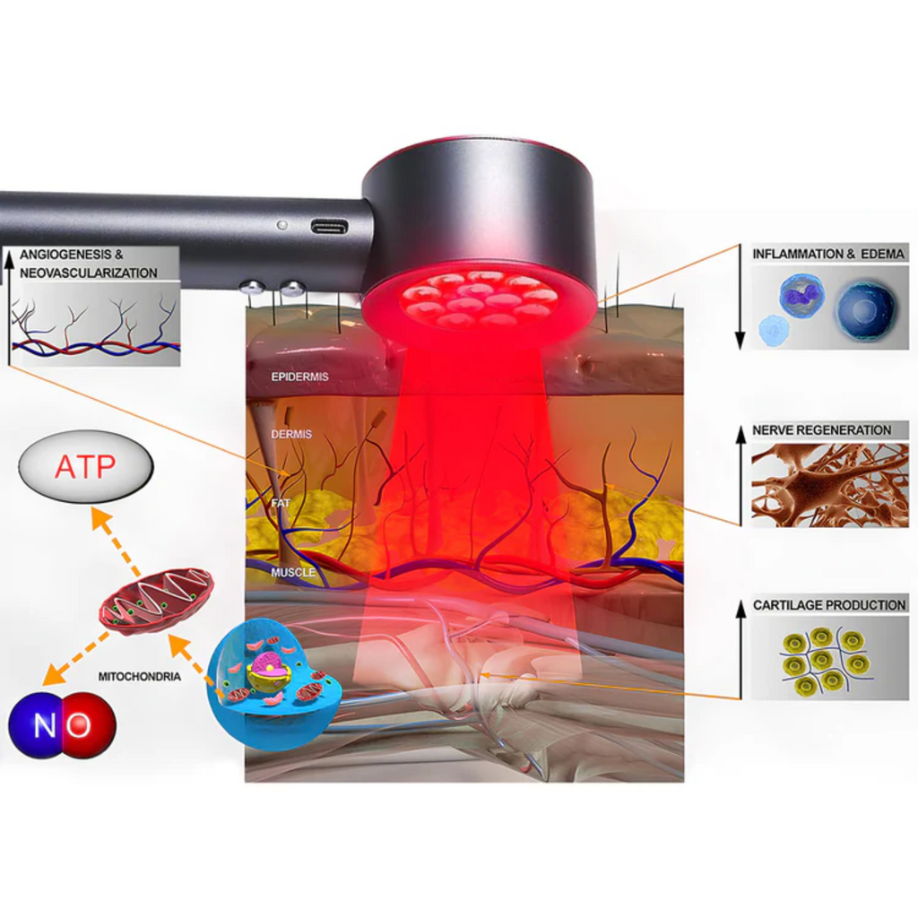 Red and Blue Light Therapy Handheld Device Best At Home Low-level laser therapy
