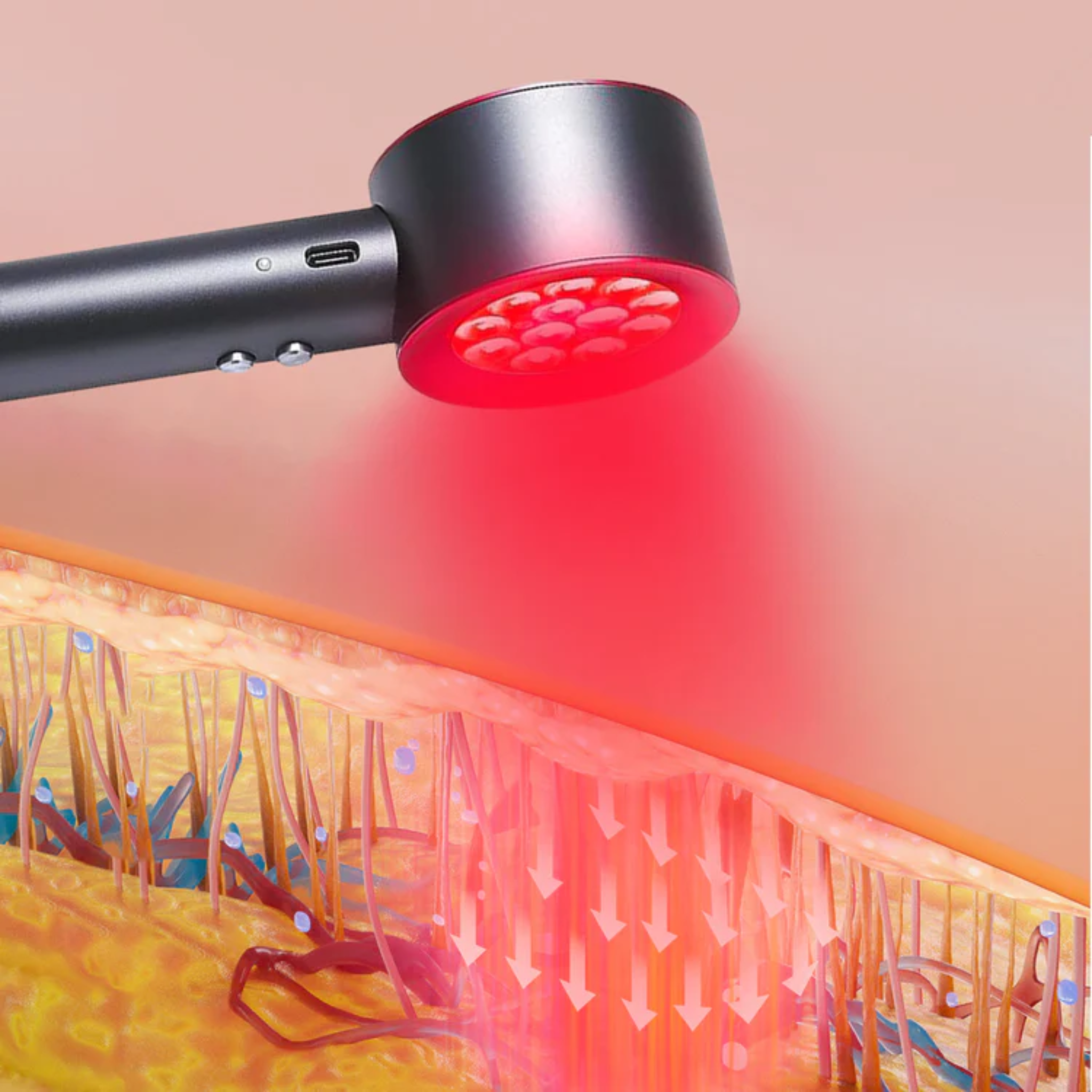 Red and Blue Light Therapy Handheld Device Best At Home Low-level laser therapy