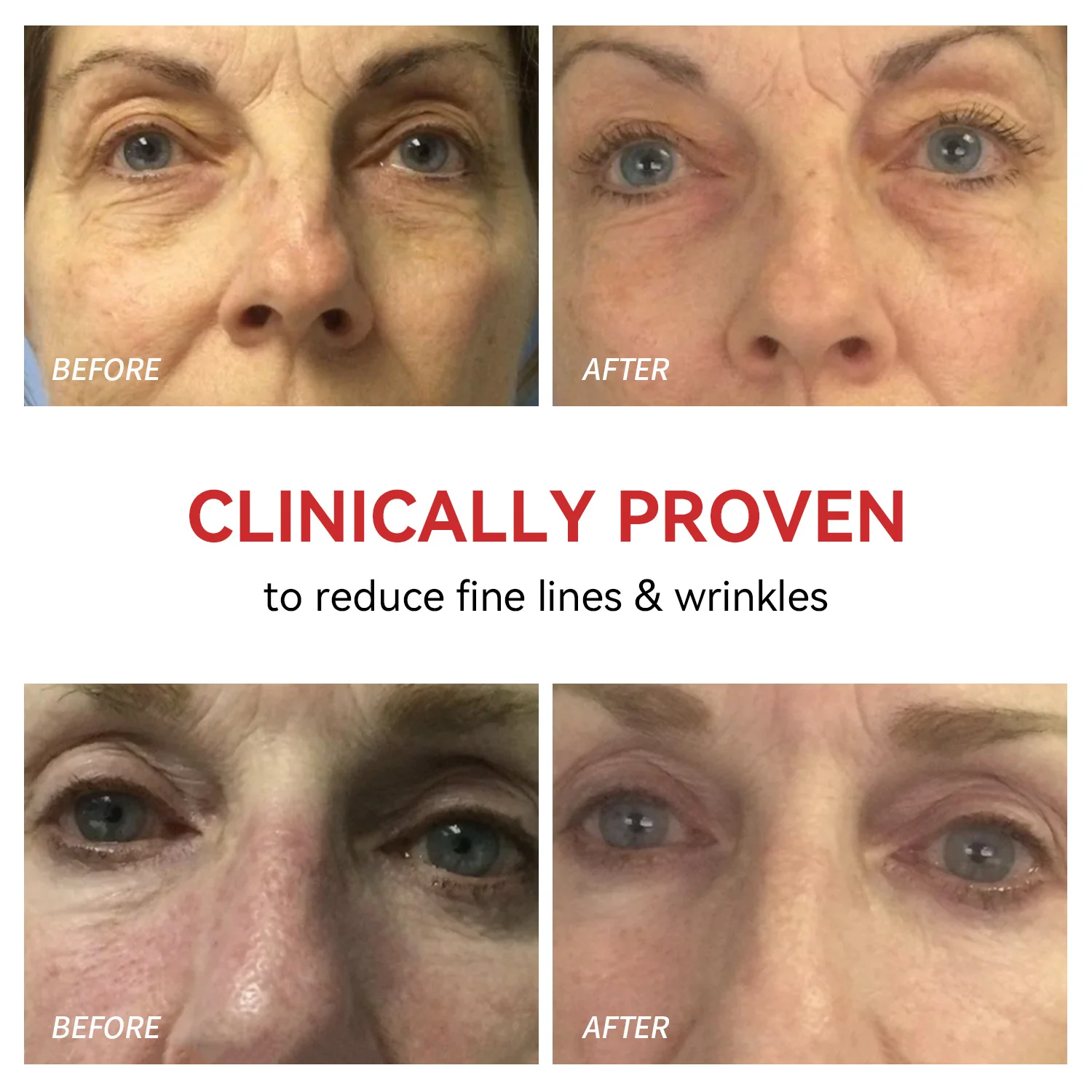 Red Light Therapy for Eyes | Reduce Fine Lines and Wrinkles |Anti Eye Bags