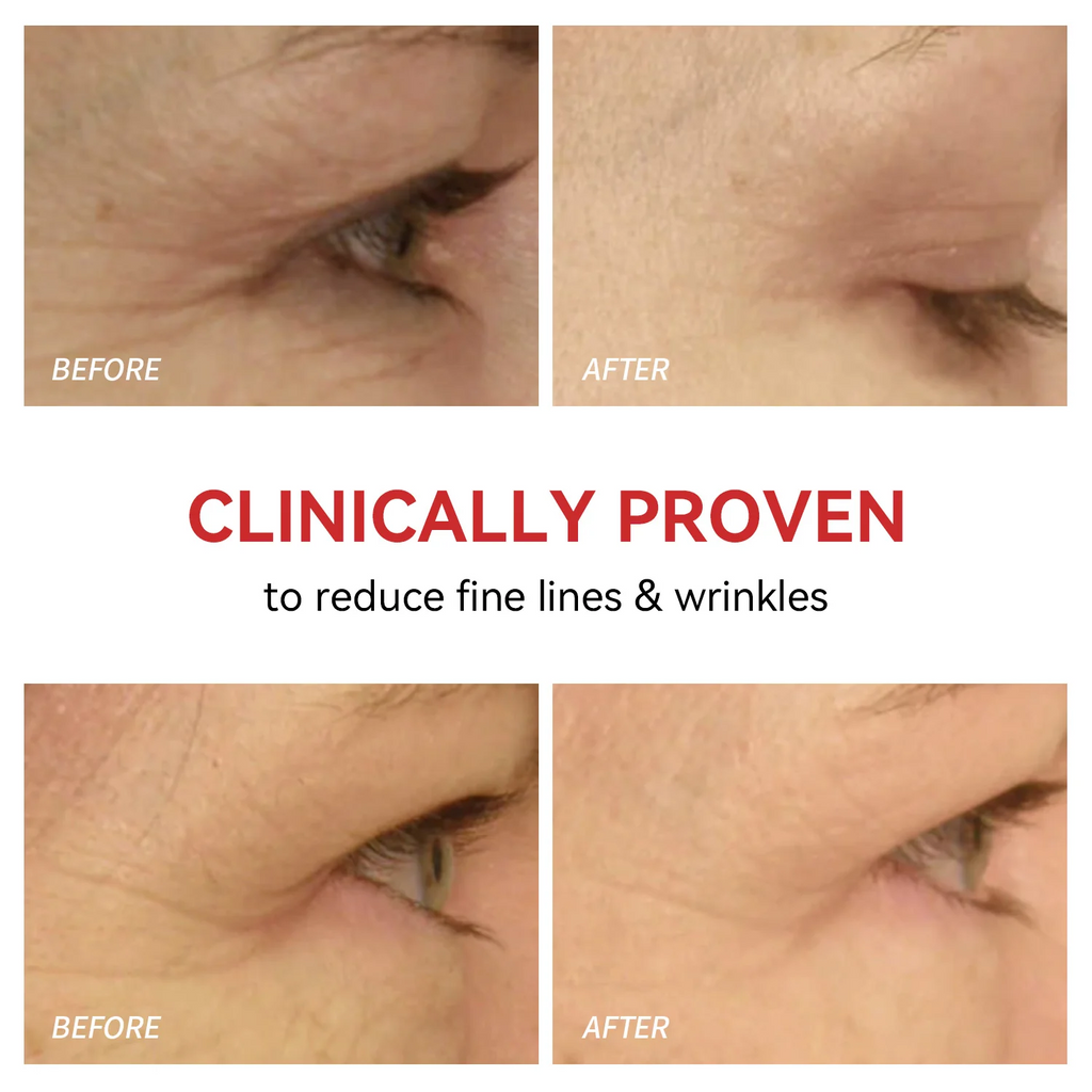 Red Light Therapy for Eyes | Reduce Fine Lines and Wrinkles |Anti Eye Bags