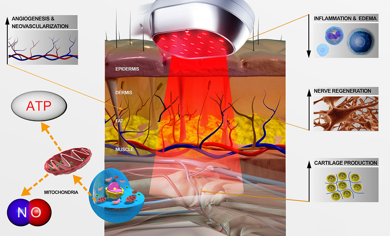Vylepšené zařízení pro terapii červeným světlem s chlazeným laserem