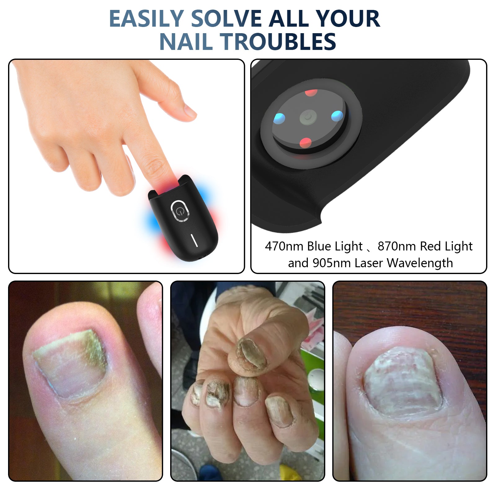 Nail Fungus Laser Treatment Device