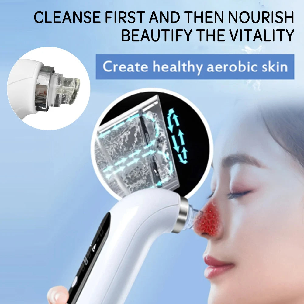 Upgraded Blackhead Remover Pore Vacuum